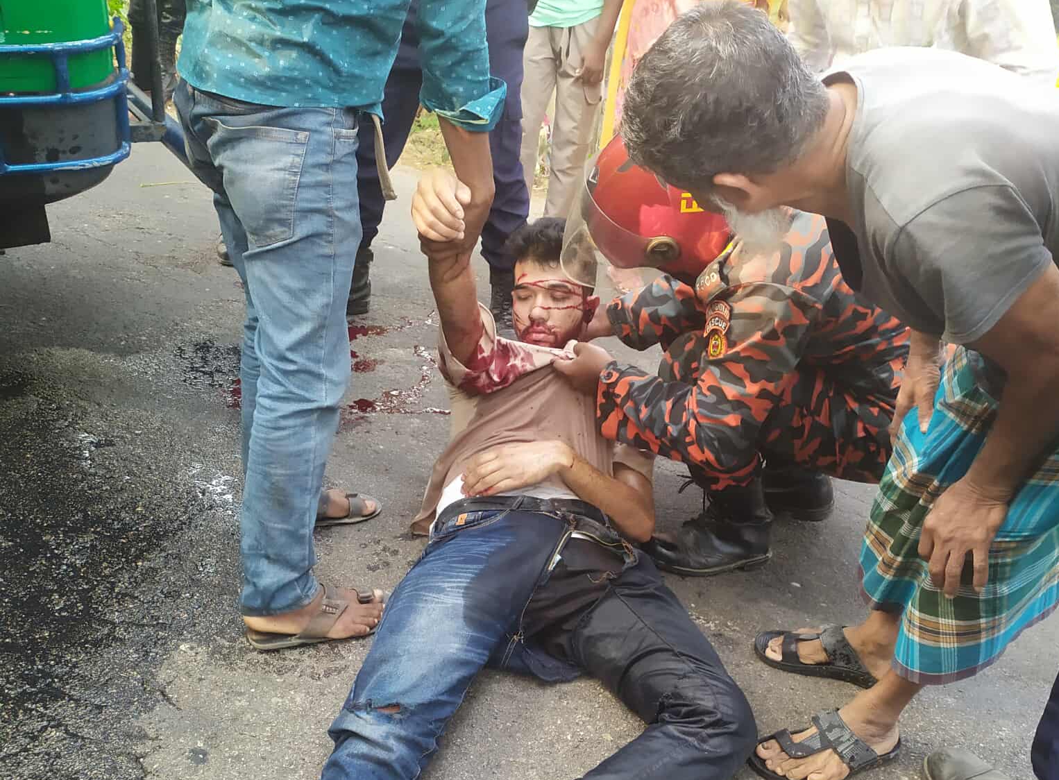 দুমকীতে মাহিন্দ্রা দুর্ঘটনায় আহত ৫ জনের ৩ জনই গুরুতর