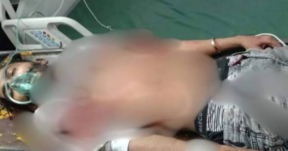প্রকাশ্যে শহিদ মিনারে মাথায় গুলিবিদ্ধ কন্টেন্ট ক্রিয়েটর রাকিব মারা গিয়েছে