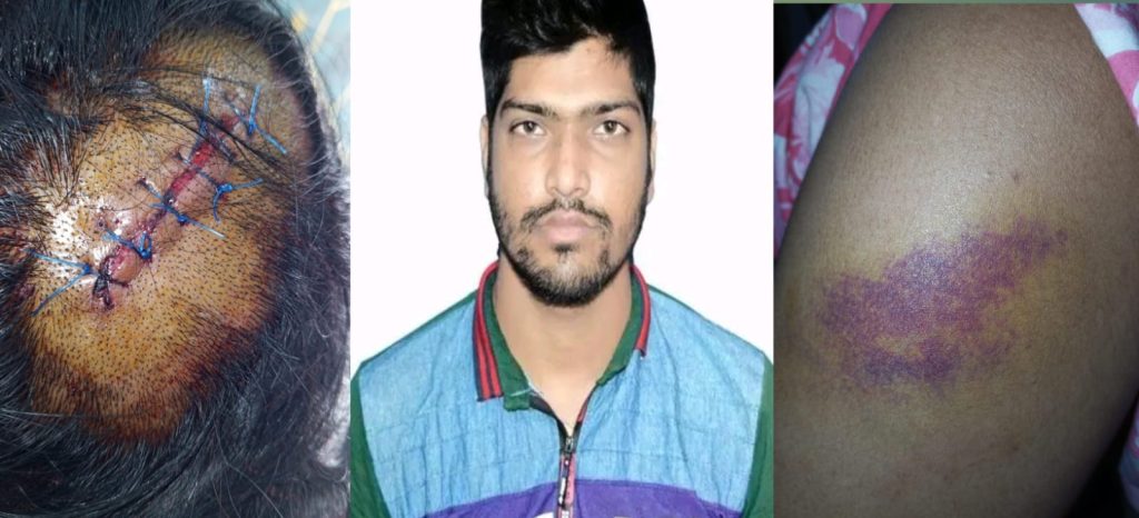 যৌতুকের টাকা না পেয়ে গৃহবধূকে হত্যাচেষ্টা, মাথায় ১০ সেলাই