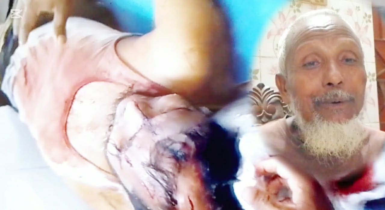 ​রাজারহাটে জমির খুঁটি না থাকাকে কেন্দ্র করে রক্তক্ষয়ী সংঘর্ষ: আহতের অবস্থা আশঙ্কাজনক